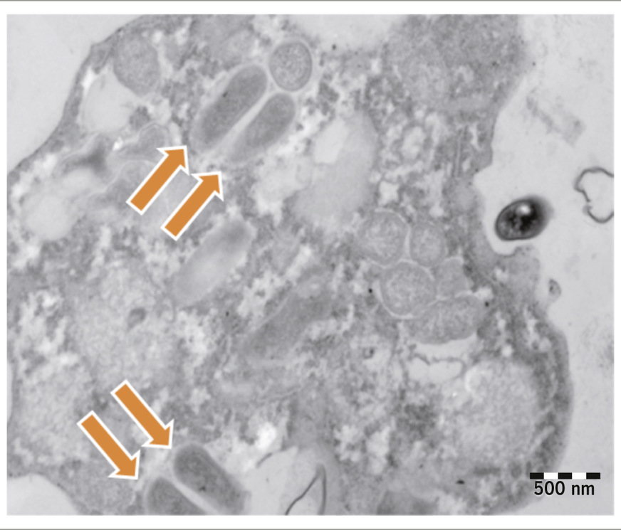 Abb. 2:  Transmissionselektronenmikroskopische Aufnahme von interzellulären CVB5-Viruspartikeln in aktiven Vermamoeba vermiformis und von ihnen ausgestoßenen Abfallvesikeln (adaptiert von Atanasova et al. 2018)