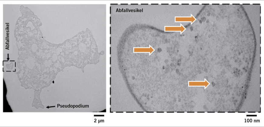 Abb. 3:  Transmissionselektronenmikroskopische Aufnahme einer aus aus dem Trinkwasser isolierten Amöbe mit interzellularen Bakterien (Pfeile; adaptiert von Muchesa et al. 2017)