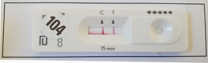 Abb. 2:  Beispiel für ein positives Testergebnis im Point-of-care-Antigenschnelltest