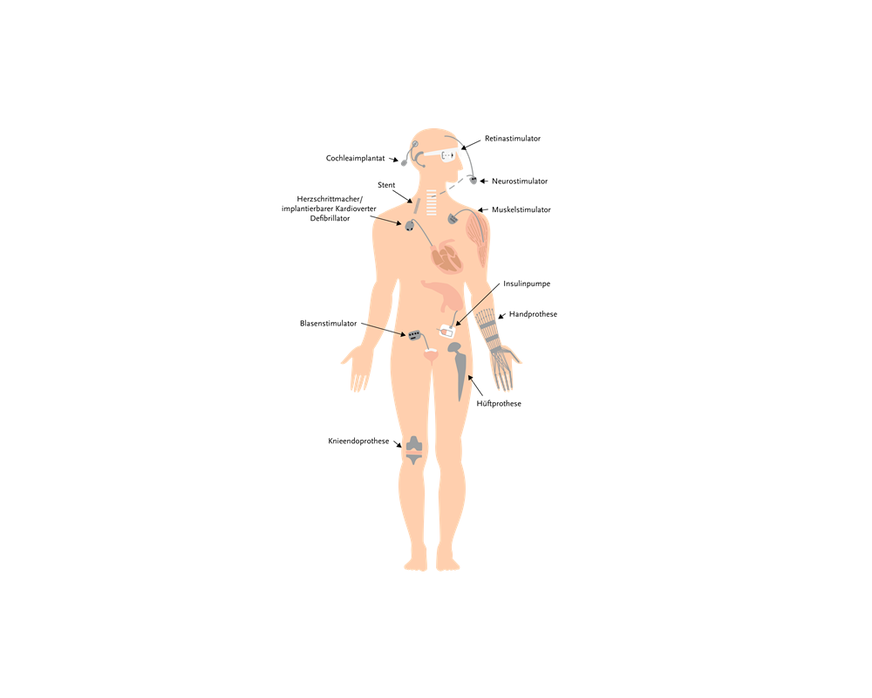 Abb. 3: Überblick über aktive und passive Implantate (Quelle: BAuA)