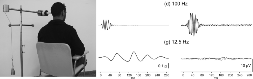 Abb. 2: Kein Luftschall: Vibrationseinleitung am Mastoid mit Shaker in den Versuchen von Todd et al. Mit 0.1&nbsp;g Amplitude der Schädelbeschleunigung (linke Wellenformen) ergaben sich die höchsten oVEMPs (rechte Wellenformen) bei 100 Hz. Bei 12.5&nbsp;Hz waren sie bereits 20 dB schwächer.