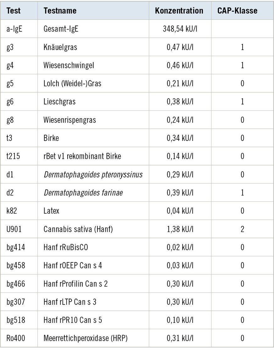 Tabelle 2:  Ergebnisse ImmunoCAP Gesamt- und spezifisches IgETable&nbsp;2: ImmunoCAP total and specific IgE results