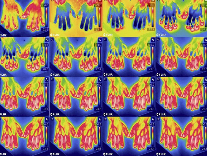 Abb.&nbsp;8:  Beispiel der Dokumentation ICE: ­gesunder Proband