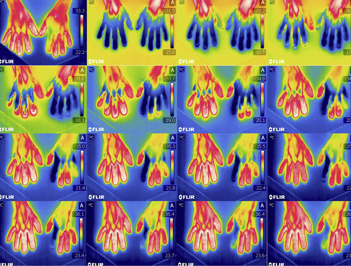 Abb. 9:  Beispiel der Dokumentation ICE: ­Patient