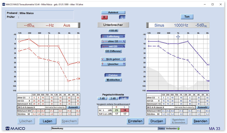 Abb.&nbsp;2:  Vergleich der Hörschwellen mit und ohne Gehörschutz mittels Audiometer (Typ Maico MA 33)