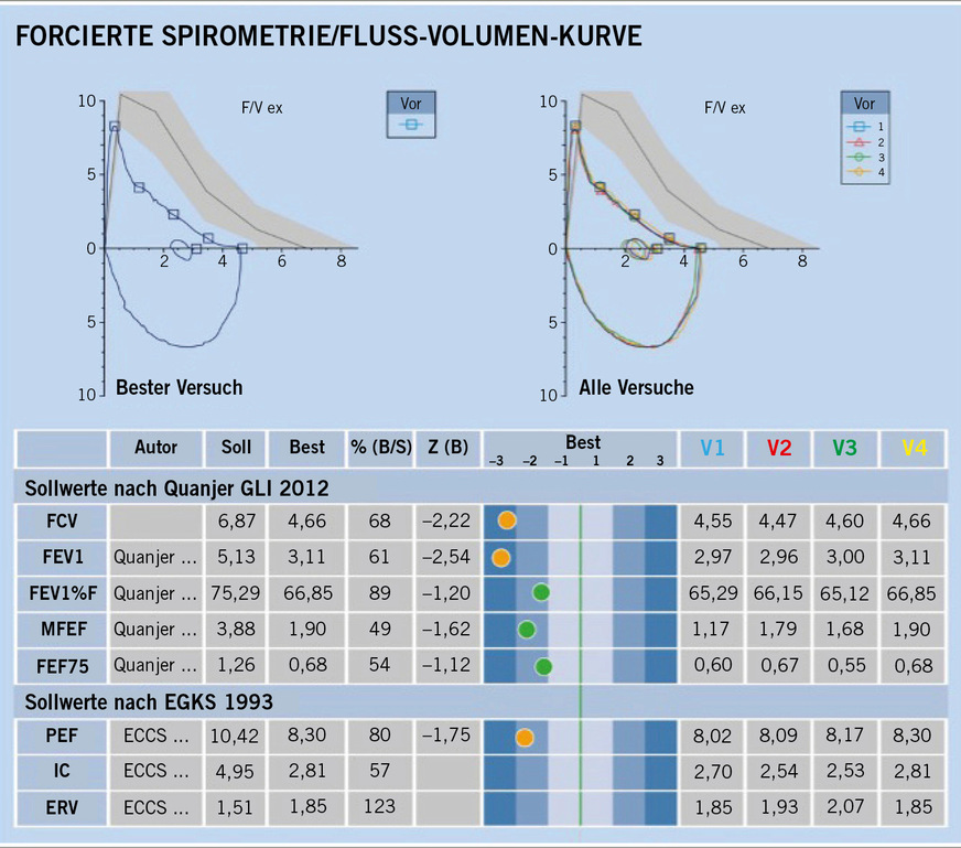Abb. 3:  Beispiel Lungenfunktionsprotokoll (Criée, Smith, Preisser et al. 2024)