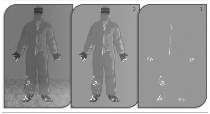 Abb. 1:  Skizze des Originalbildes und der Ergebnisse durch die einzelnen Bearbeitungsschritte. 1) Originalbild: Darstellung des Rohbildes ohne Bearbeitung, auf dem die Person und der Hintergrund unverändert abgebildet sind. 2) Bild nach Segmentierung: Durch Anwendung der morphologischen Operatoren (Dilatation, Erosion, Opening, Closing) wurde der Hintergrund entfernt, so dass die Person isoliert dargestellt ist. 3) Segmentiertes Bild mit Schwellenwertsetzung: Nach der Segmentierung und durch zusätzliche Schwellenwertsetzungen (Thresholding) wurden nur die relevanten Fluoreszenzmuster extrahiert. Diese Bildstufe zeigt ausschließlich die durch die Fluoreszenz markierten Kontaminationsmuster (© D. Weißbrodt)
