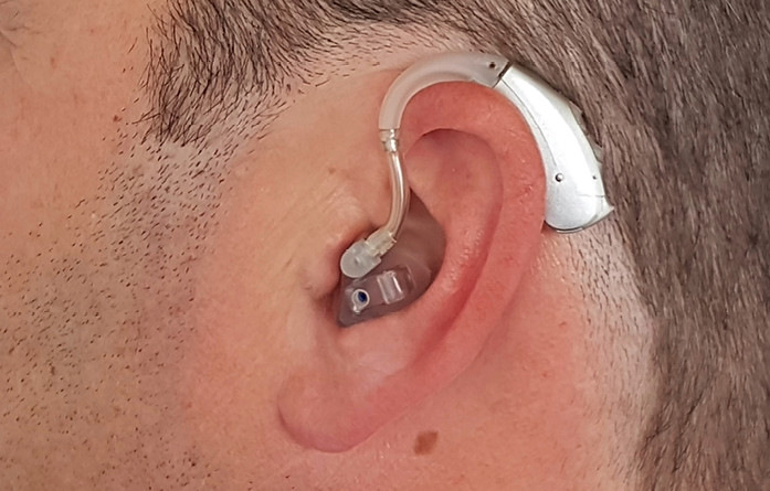 Abb. 3:  Hörgerät: Komplettsystem mit Gehörschutz-Otoplastik und HdO-Gerät