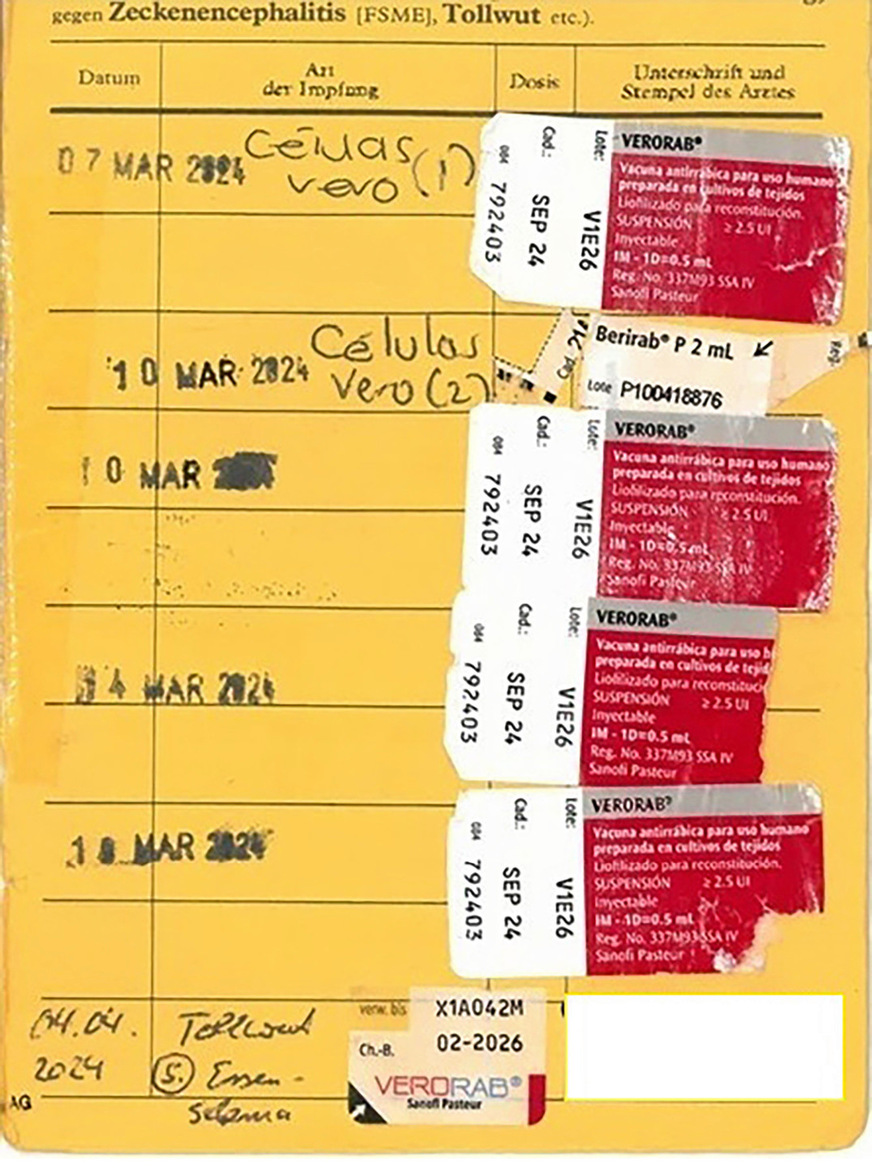 Abb. 5:  Impfpass des Patienten mit einer Passivimpfung und 5 Aktiv­impfungen, wobei die letzte Impfung nach Essen-Schema nach Rückkehr in Deutschland ergänzt wurde