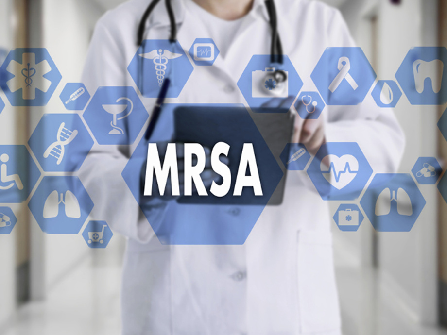 Mrsa Screening Von Personal Im Gesundheitswesen Asu
