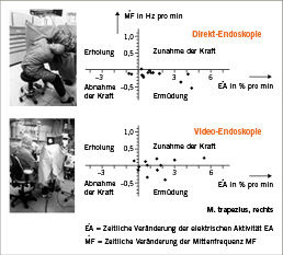 
 Abb. 3: 
 Beurteilung des M. trapezius in Bezug auf zwei Endoskopieverfahren mittels JASA nach Luttmann et al. (1996a)
