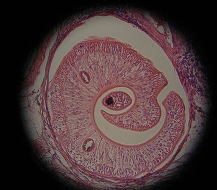 <p>
<span class="GVSpitzmarke"> Abb. 3: </span>
 Schistosomen-Wurmpaar im histologischen Schnitt. Zentral das Weibchen mit bluthaltigem Darminhalt, umschlossen vom Männchen (Foto: Rieke)
</p>