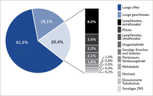 
 Abb. 1: 
 Anteil verschiedener Organsysteme an den 2011 gemeldeten Tuberkulosefällen (aus: RKI 2013a)


