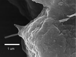 
 Abb. 2: 
 Elektronenoptisches Bild zur Penetration von MWCNT-Fasern durch das Alveolarepithel (1 Tag nach Aspiration von 80 µg bei der Maus). (Aus Mercer et al. 2010; Reproduktion unter Creative Commons Attribution Licence/Open Access)


