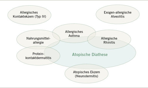 
 Abb. 3: 
 Erkrankung mit und ohne Beziehung zur atopischen Diathese
