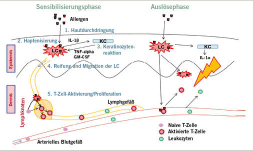 <p>
<span class="GVSpitzmarke"> Abb. 3: </span>
 Mechanismus der Sensibilisierung und der allergischen Reaktion (Heine et al. 2013)
</p>