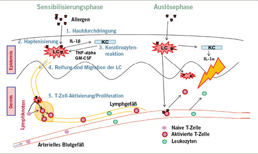 
 Abb. 3: 
 Mechanismus der Sensibilisierung und der allergischen Reaktion (Heine et al. 2013)
