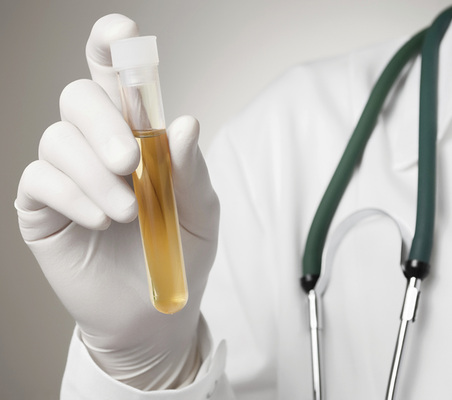 



Eine gesetzliche Grundlage für eine allgemeine Alkoholkontrolle bw. ein generelles Drogenscreening existiert im Arbeitsrecht nicht
