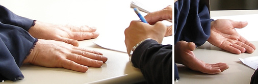 
 Abb. 4: 
 HEROS – Untersuchungen zur Intraobserver-Variabilität, Befundung der Hände (a: dorsal, b: palmar) durch das Untersuchungsfenster; zu untersuchende Person ist hinter einem Sichtschutz verborgen
