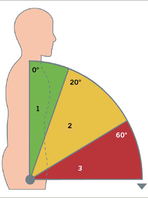 
 Abb. 3: 
 Bewertung der sagittalen Neigung des Oberkörpers
