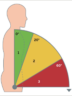 <p>
<span class="GVSpitzmarke"> Abb. 3: </span>
 Bewertung der sagittalen Neigung des Oberkörpers
</p>