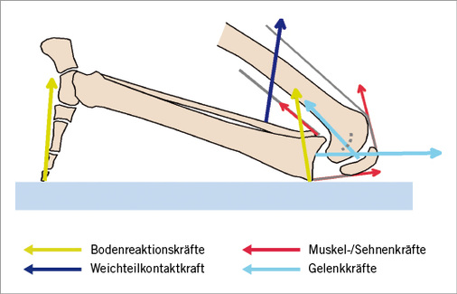 
 Abb. 2: 
 Schematische Darstellung des biomechanischen Modells zur Bestimmung der Kniegelenkkräfte beim Hocken und Knien (nach Glitsch et al. 2009)



