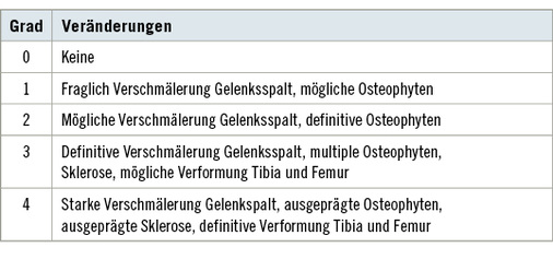 <p>
<span class="GVSpitzmarke"> Tabelle 1: </span>
 Kellgren-Lawrence-Skala
</p>

<p class="GVBildunterschriftEnglisch">
</p>