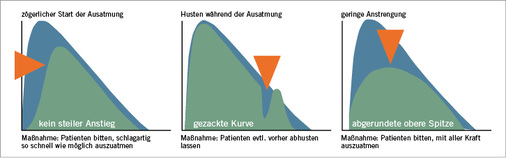 
 Abb. 3: 
 Fehlerzeichen (blauer Kurvenbereich = optimale Mitarbeit)
