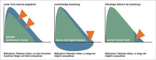 
 Abb. 4: 
 Fehlerzeichen (blauer Kurvenbereich = optimale Mitarbeit)
