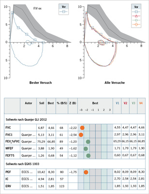 <p>
<span class="GVSpitzmarke"> Abb. 7: </span>
 Forcierte Spirometrie/Fluss-Volumen-Kurve. Lungenfunktionsprotokoll mit Angabe der Autoren der Normalwerte sowie der gemessenenWerte (Best) in Bezug zu den Sollwerten (% (B/S), identisch mit % Soll) sowie Angabe des Z-Scores. Werte unterhalb des Z-Scores von 1,645 sind orange eingetragen als pathologische Werte, Werte im Normbereich bis zu einem Z-Score von 1,645 sind grün markiert
</p>