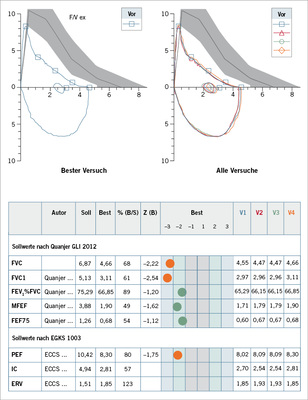 
 Abb. 7: 
 Forcierte Spirometrie/Fluss-Volumen-Kurve. Lungenfunktionsprotokoll mit Angabe der Autoren der Normalwerte sowie der gemessenenWerte (Best) in Bezug zu den Sollwerten (% (B/S), identisch mit % Soll) sowie Angabe des Z-Scores. Werte unterhalb des Z-Scores von 1,645 sind orange eingetragen als pathologische Werte, Werte im Normbereich bis zu einem Z-Score von 1,645 sind grün markiert
