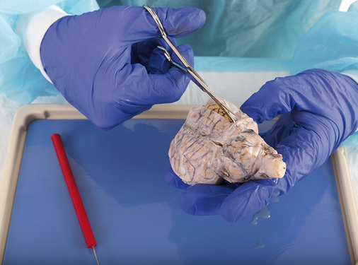 



In der Pathologie kommt es zum Kontakt mit potenziell infektiösen Geweben oder Organen
