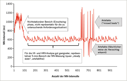 
 Abb. 2: 
 Prinzip der Auswahl eines geeigneten 5-min-Bereichs der NN-Messung aus einer artefaktüber-lagerten Aufzeichnung mit vorangegangenem nichtstationärem Bereich
