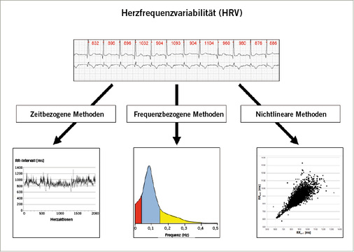 
 Abb. 3: 
 Übersicht über die Möglichkeiten der HRV-Analyse mit Beispielen möglichen grafischen Dar-stellungen
