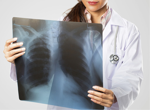 
Der (Betriebs)Arzt ist bei der Beurteilung der Arbeitsfähigkeit von Personen mit chronischen Erkrankungen wie der COPD unverzichtbar



