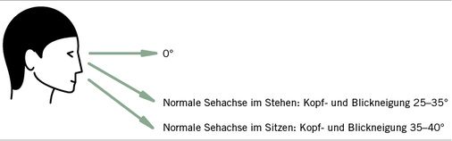 
 Abb. 3: 
 Gesamtauslenkung normale Sehachse
