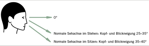 <p>
<span class="GVSpitzmarke"> Abb. 3: </span>
 Gesamtauslenkung normale Sehachse
</p>