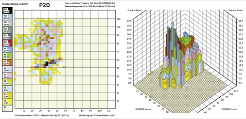 
 Abb. 4: 
 Ergebnis einer Druckmessung mit dem KDMG (Quelle IFA)
