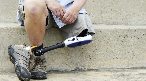 <p>
Laut Bundessozialgericht rechtfertigt die Versorgung mit einer C-Leg-Prothese nicht die Verringerung der MdE, da die Prothese den funktionellen Körperschaden nicht vollständig kompensiere
</p>

<p>
</p> - © Foto: ottoblotto / Thinkstock

