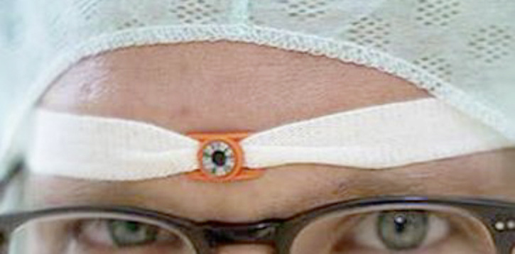 Abb. 1:   Trageweise des Augendosimeters 
 
 Fig. 1: Way of wearing the eye dosimeter - © Foto: BG Klinikum Hamburg / Jens Jarmer
