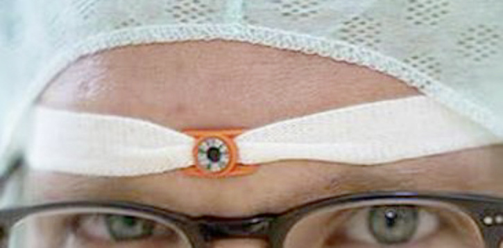  Abb. 1:   Trageweise des Augendosimeters 
 
 Fig. 1: Way of wearing the eye dosimeter