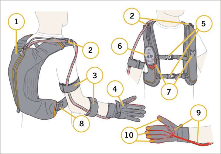  Abb. 1:    Prinzipskizze IronHand ®  modifiziert (Bioservo Technologies AB 2019): 1 = Rucksack mit Aktoreinheit und Akku, 2 = Befestigung des Führungsschlauches der künstlichen Sehnen, 3 = elastische Armbänder, 4 = IronHand ® -Handschuh, 5 = vordere Befestigungsgurte, 6 = Bedienpanel, 7 = Befestigung Bedienpanel, 8 = seitlicher Verbindungsgurt, 9 = künstliche Sehnen (rot), 10 = Kraftsensoren im IronHand®-Handschuh
 
 Fig. 1: Principle drawing IronHand ®  modified (Bioservo Technologies AB 2019): 1 = Backpack with control unit and battery, 2 = Tube attachment of artificial tendons, 3 = Elastic arm straps, 4 = IronHand ®  glove, 5 = Front fastening straps, 6 = Control panel, 7 = Control panel attachment, 8 = Side tie strap, 9 = Artificial tendons (red), 10 = Force sensors in IronHand ®  glove