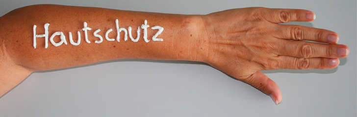 Hautschutz trägt wesentlich dazu bei, Hautkrankheiten zu verhindern beziehungsweise sie zu lindern