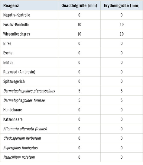 Tabelle 1:   Ergebnisse Prick-Test
 Table 1: Skin prick test results