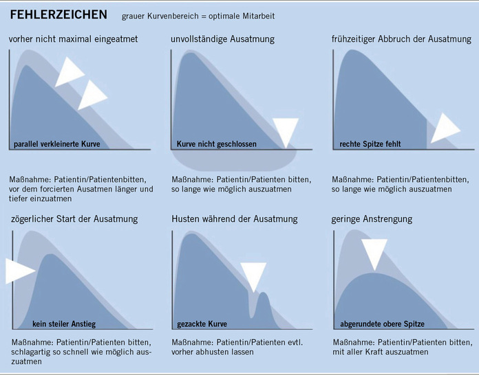 Abb. 1:   Fehlerzeichen (nach Criée, Smith, Preisser et al. 2024)