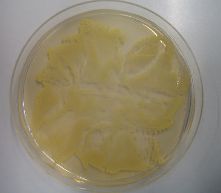 <p>
Staphylococcus aureus auf Agar (© Wikipedia)
</p>