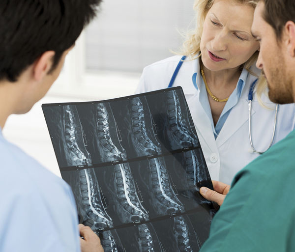 <p>
Für die gutachtliche Beurteilung einer Wirbelsäulen-Berufskrankheit sollten Röntgenaufnahmen aller Wirbelsäulenabschnitte ausgewertet werden
</p> - © © Ridofranz/Thinkstock

