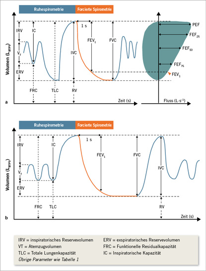 
 Abb. 1: 
 Statische und dynamische Lungenfunktionsparameter und maximale exspiratorische Flüsse. 
a
 Standardabfolge mit Bestimmung der inspiratorischen Vitalkapazität (IVC) mit nachfolgender forcierter Spirometrie (siehe Text). 
b
 Ab-lauf bei eingeschränkter Kooperationsfähigkeit (Kinder, Schwerkranke) mit Bestimmung der IVC nach der forcierten Spirometrie. IRV = inspiratori-sches Reservevolumen, ERV = exspiratorisches Re-servevolumen, VT = Atemzugvolumen, FRC = funktionelle Residualkapazität, TLC = totale Lungenkapazität, IC = inspiratorische Kapazität, übrige Parameter wie Tabelle 1
