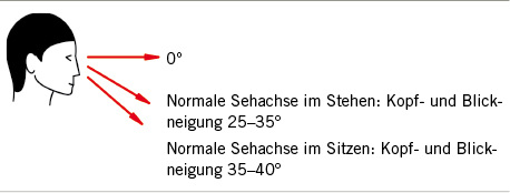 
 Abb. 1: 
 Gesamtauslenkung normale Sehachse
