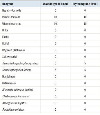 Tabelle 1:   Ergebnisse Prick-Test
 Table 1: Skin prick test results